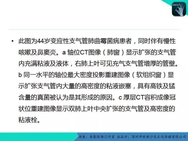 【PPT】支气管扩张：相关常见及不常见疾病的机制及影像特征