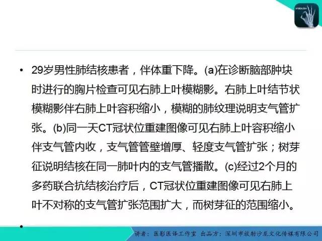 【PPT】支气管扩张：相关常见及不常见疾病的机制及影像特征