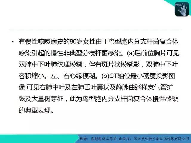 【PPT】支气管扩张：相关常见及不常见疾病的机制及影像特征
