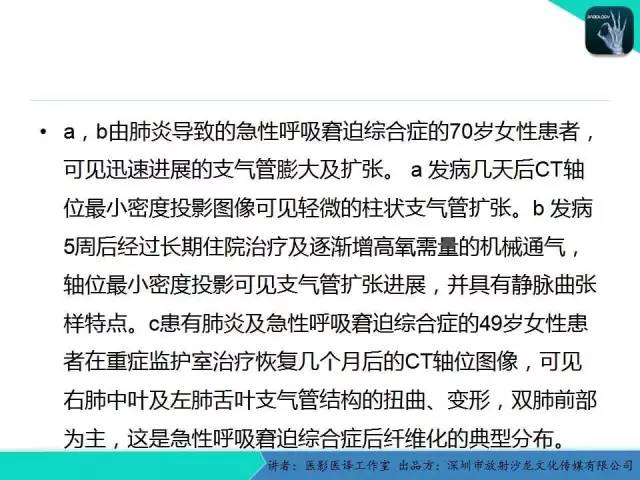 【PPT】支气管扩张：相关常见及不常见疾病的机制及影像特征
