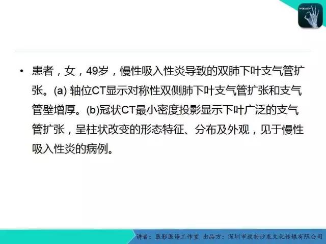 【PPT】支气管扩张：相关常见及不常见疾病的机制及影像特征