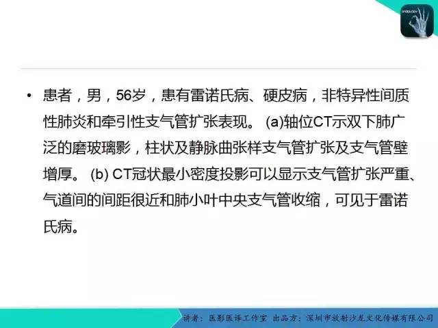【PPT】支气管扩张：相关常见及不常见疾病的机制及影像特征