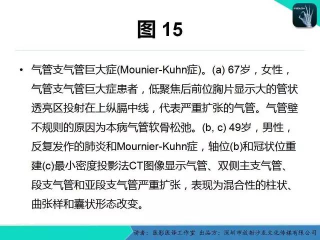 【PPT】支气管扩张：相关常见及不常见疾病的机制及影像特征