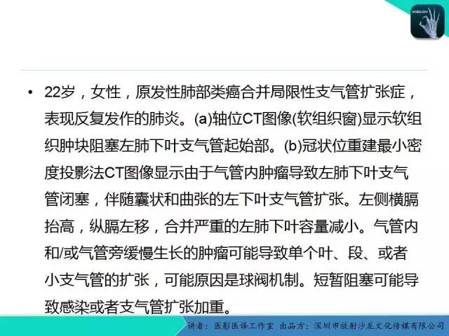 【PPT】支气管扩张：相关常见及不常见疾病的机制及影像特征
