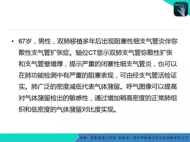 【PPT】支气管扩张：相关常见及不常见疾病的机制及影像特征