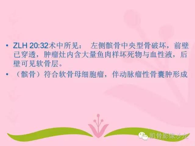 【病例】软骨母细胞瘤合并ABC一例X线及MR影像表现
