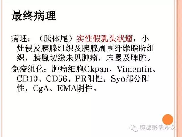 【病例】胰体尾实性假乳头状瘤1例CT影像表现 【病例】胰体尾实性假乳头状瘤1例CT影像表现