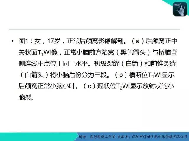 【PPT】后颅窝异常的神经影像学表现