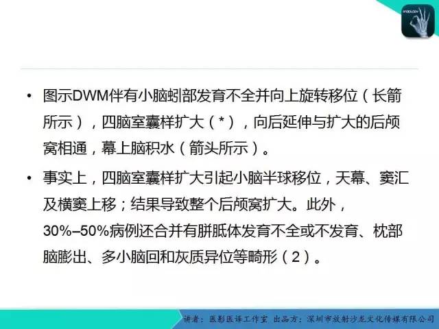 【PPT】后颅窝异常的神经影像学表现