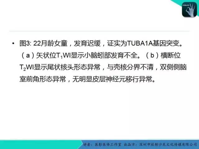【PPT】后颅窝异常的神经影像学表现