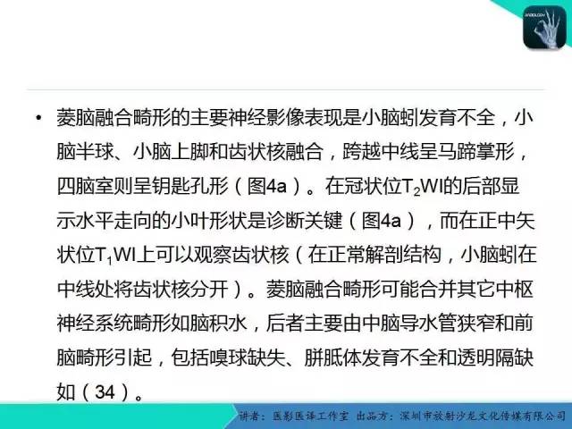 【PPT】后颅窝异常的神经影像学表现