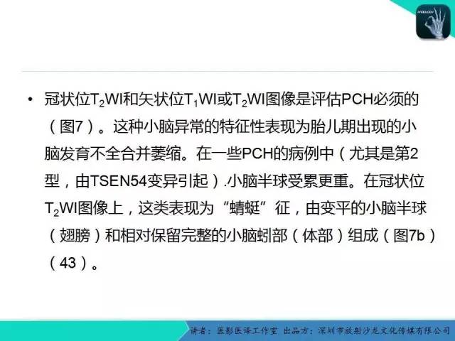 【PPT】后颅窝异常的神经影像学表现