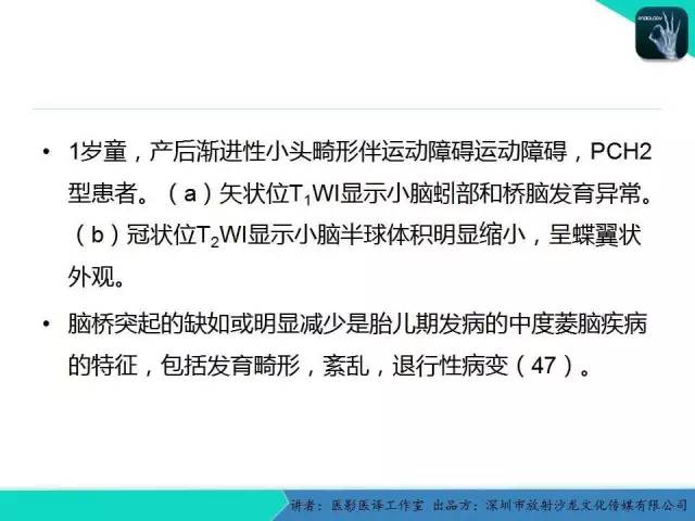 【PPT】后颅窝异常的神经影像学表现