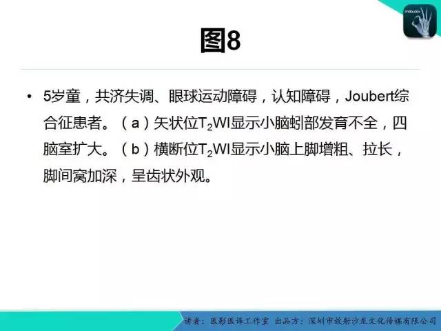 【PPT】后颅窝异常的神经影像学表现