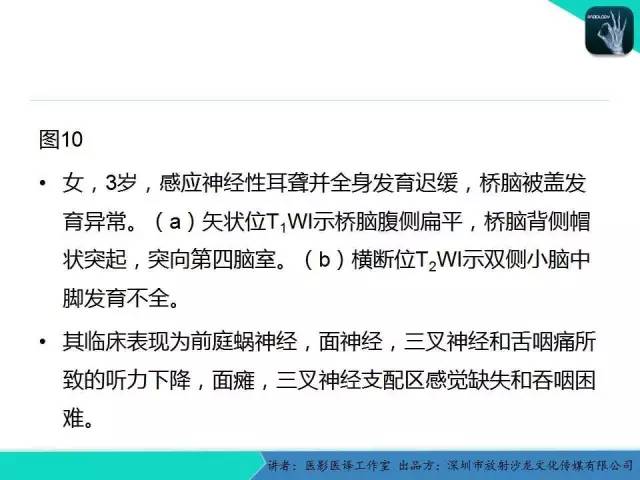 【PPT】后颅窝异常的神经影像学表现