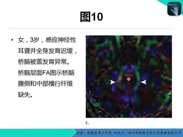 【PPT】后颅窝异常的神经影像学表现
