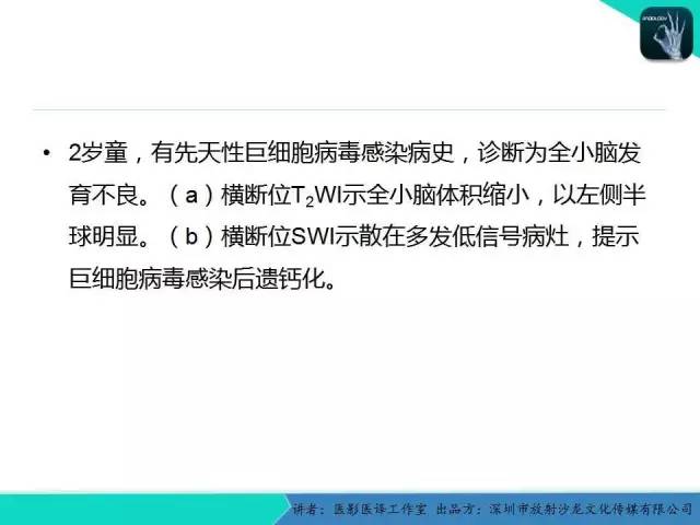 【PPT】后颅窝异常的神经影像学表现