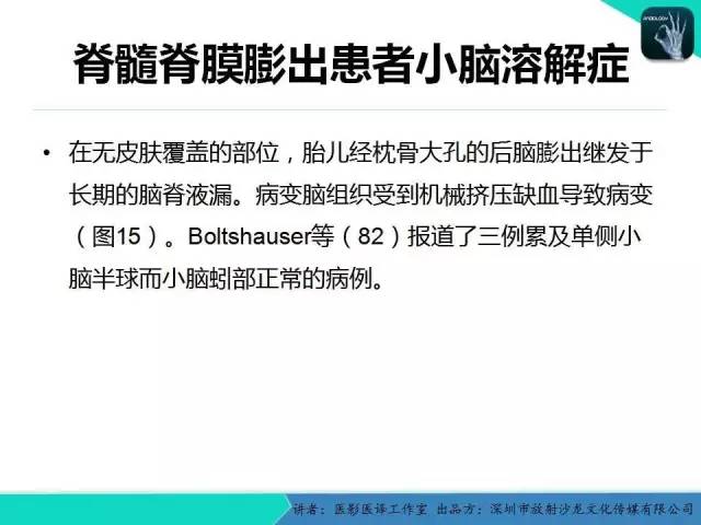 【PPT】后颅窝异常的神经影像学表现