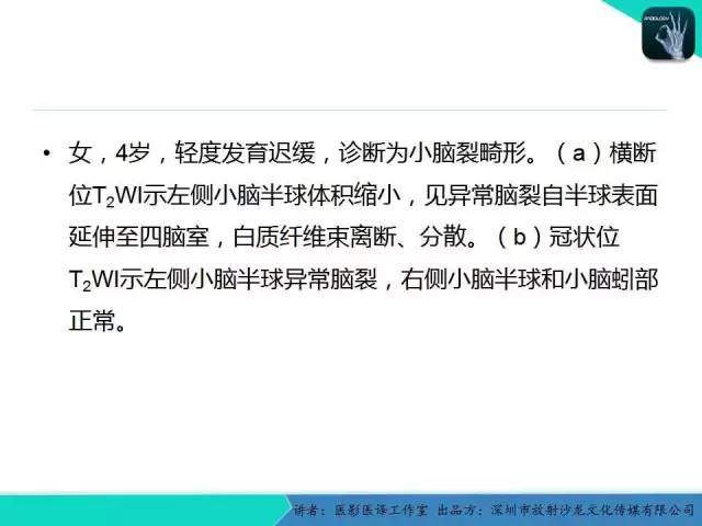 【PPT】后颅窝异常的神经影像学表现