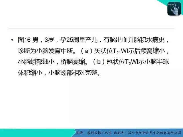 【PPT】后颅窝异常的神经影像学表现