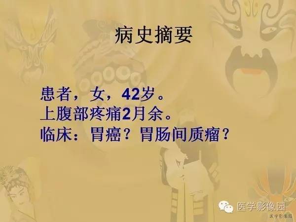 【病例】胃淋巴瘤1例CT影像表现