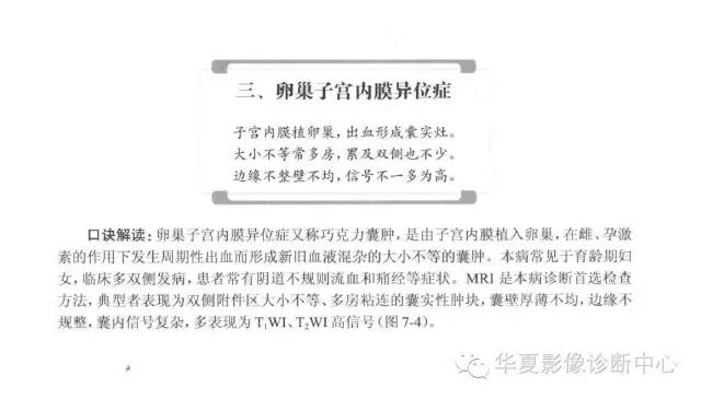 女性生殖系统诊断口诀汇总