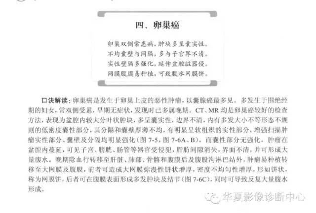 女性生殖系统诊断口诀汇总
