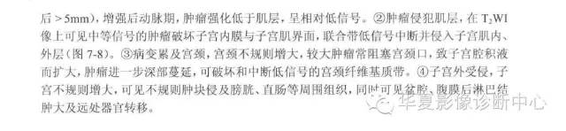 女性生殖系统诊断口诀汇总