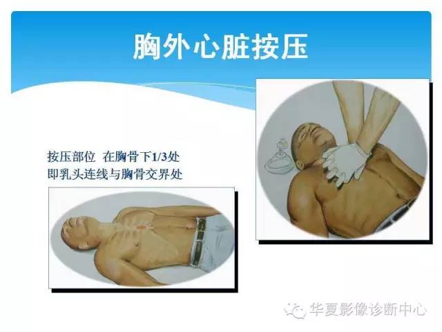 【PPT】碘对比剂不良反应的急救与预防