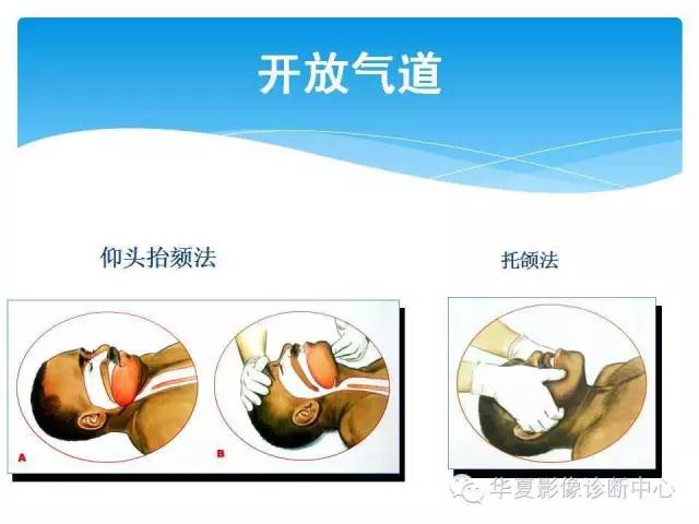 【PPT】碘对比剂不良反应的急救与预防