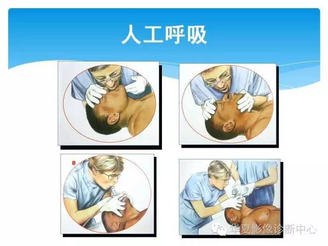 【PPT】碘对比剂不良反应的急救与预防