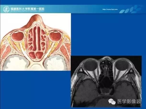 【PPT】眼眶病变的MR检查技术及诊断