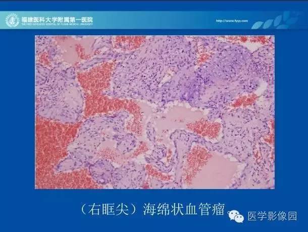 【PPT】眼眶病变的MR检查技术及诊断