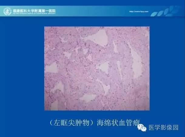 【PPT】眼眶病变的MR检查技术及诊断