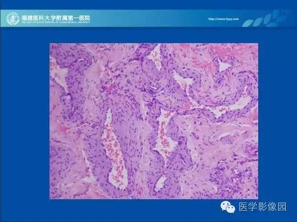 【PPT】眼眶病变的MR检查技术及诊断