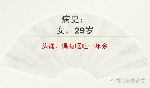 【病例】颅内神经元错构瘤1例CT及MR影像表现