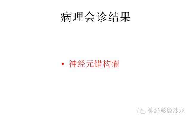 【病例】颅内神经元错构瘤1例CT及MR影像表现