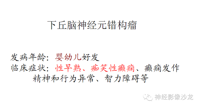 【病例】颅内神经元错构瘤1例CT及MR影像表现