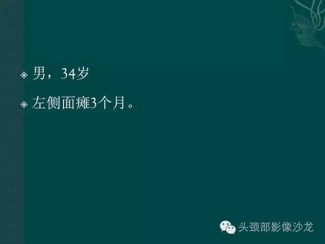 【病例】鼓室乳突区软骨肉瘤1例CT及MR影像表现