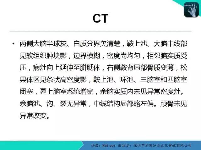 【病例】毛细胞粘液样型星形细胞瘤1例CT及MR影像表现