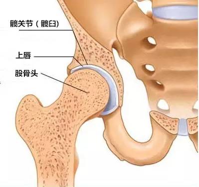髋关节疼痛之髋臼唇撕裂影像学诊断 髋关节疼痛之髋臼唇撕裂影像学诊断