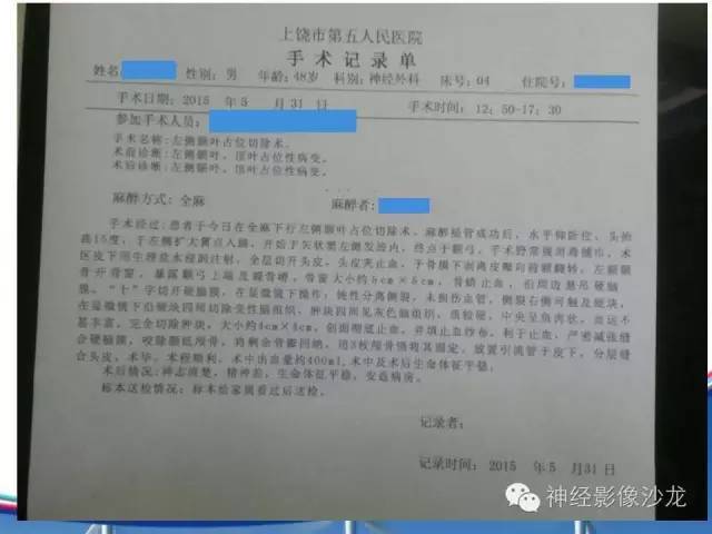【病例】胶质母细胞瘤1例MR影像表现