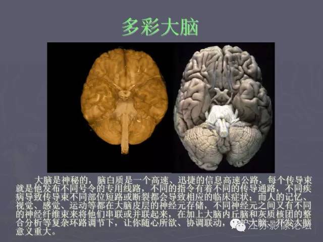 【PPT】磁共振DTI成像-投射纤维