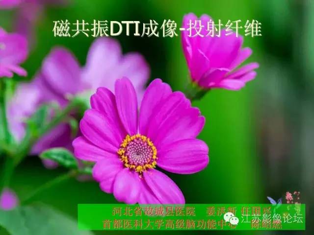 【PPT】磁共振DTI成像-投射纤维