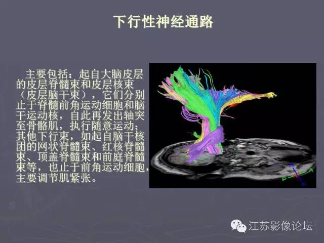 【PPT】磁共振DTI成像-投射纤维
