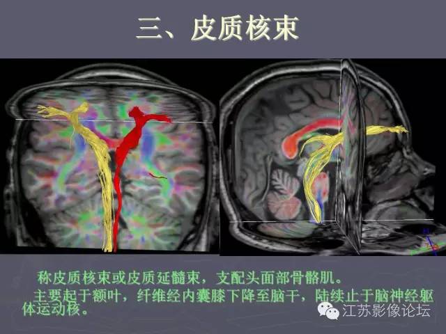 【PPT】磁共振DTI成像-投射纤维
