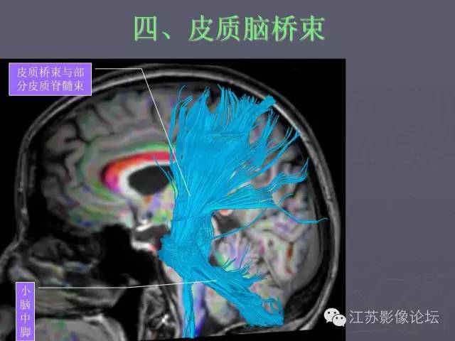 【PPT】磁共振DTI成像-投射纤维