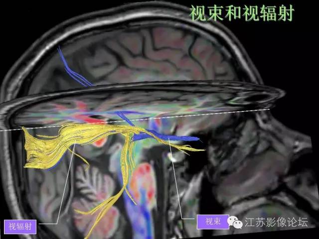 【PPT】磁共振DTI成像-投射纤维