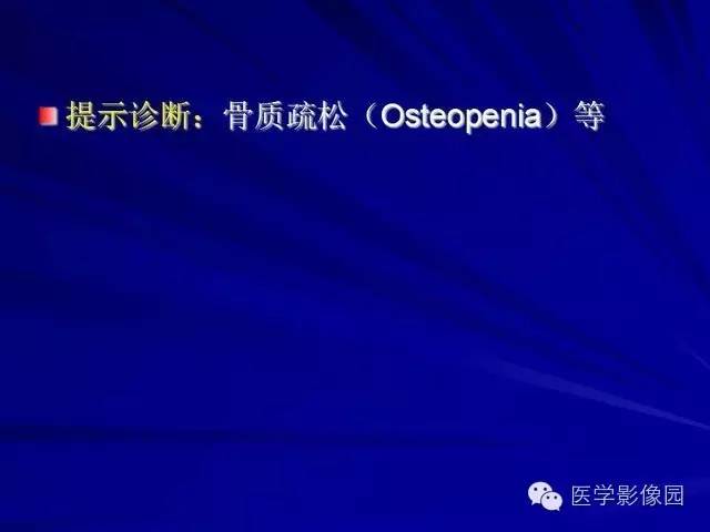 【PPT】脊柱各种征象的介绍