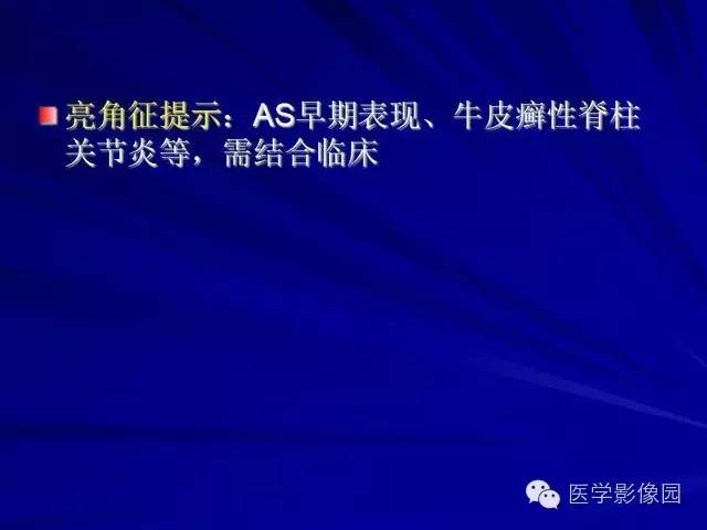 【PPT】脊柱各种征象的介绍